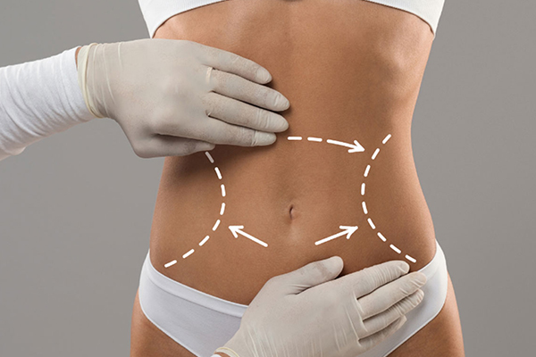 بررسی انواع روش های جراحی زیبایی پیکرتراشی و لاغری