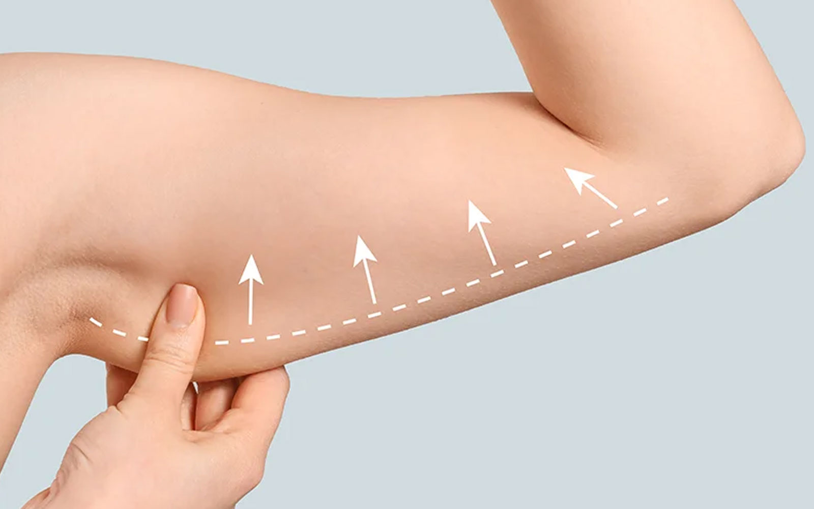 معرفی انواع روش‌های لیفت بازو
