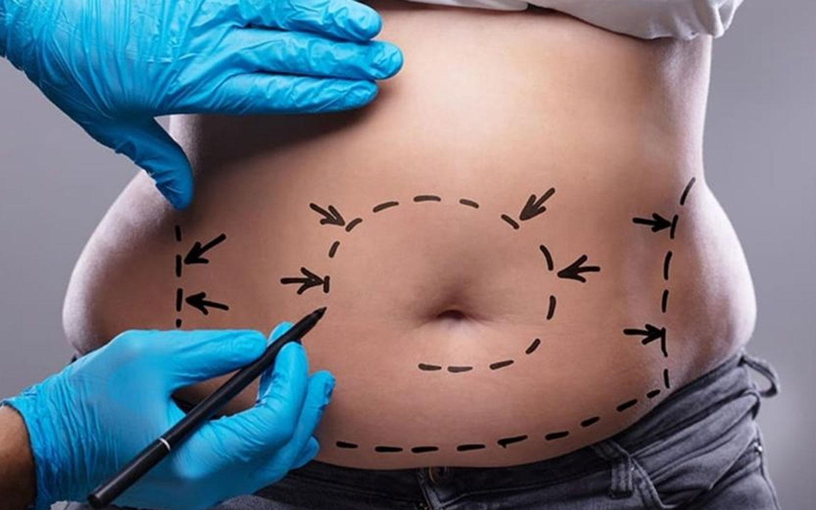 بیماری‌های مؤثر در صلاحیت انجام جراحی لاغری