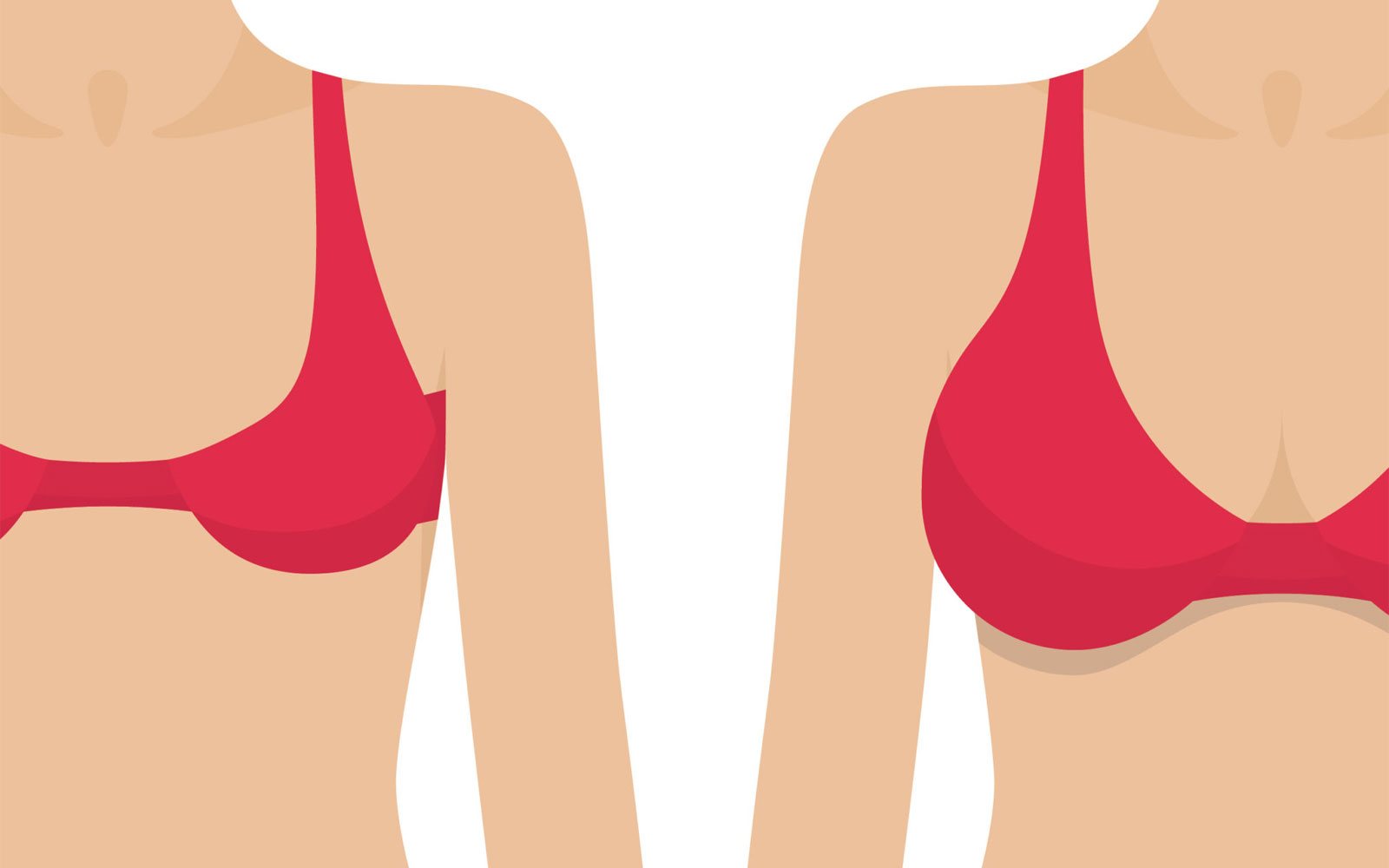 از عوارض تا پیشگیری: راهنمای کامل پروتز سینه