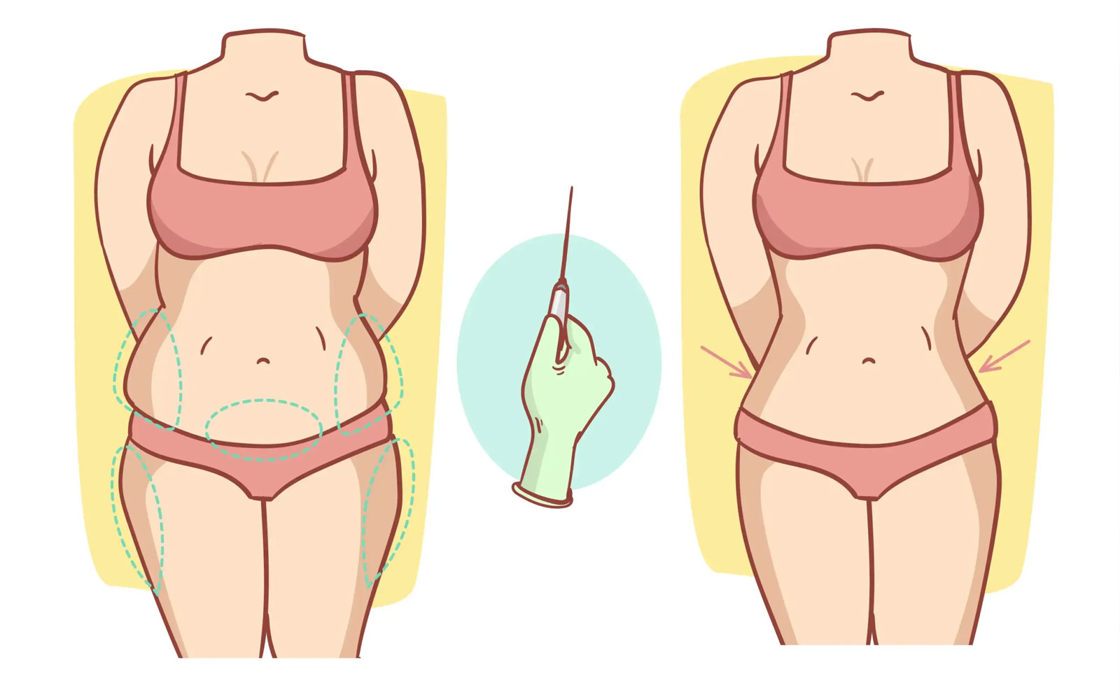نقش دستگاههای اولتراسوند در لیپو ویزر