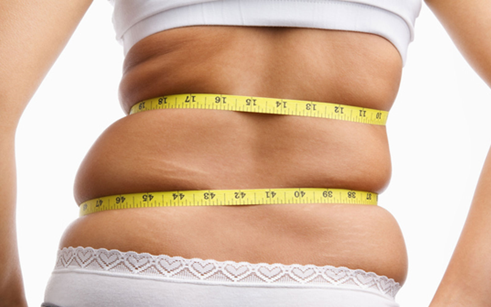 بازگشت چربیهای حذف شده در لیپوساکشن