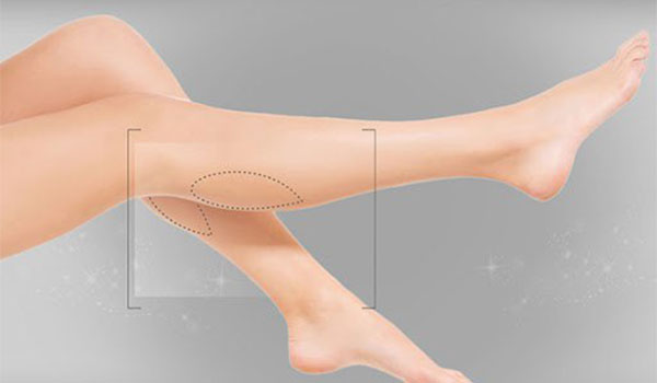 تزریق چربی به ساق پاها چیست؟